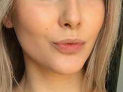 49