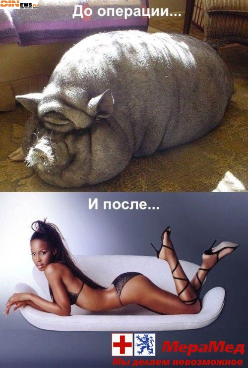 До и после операции...